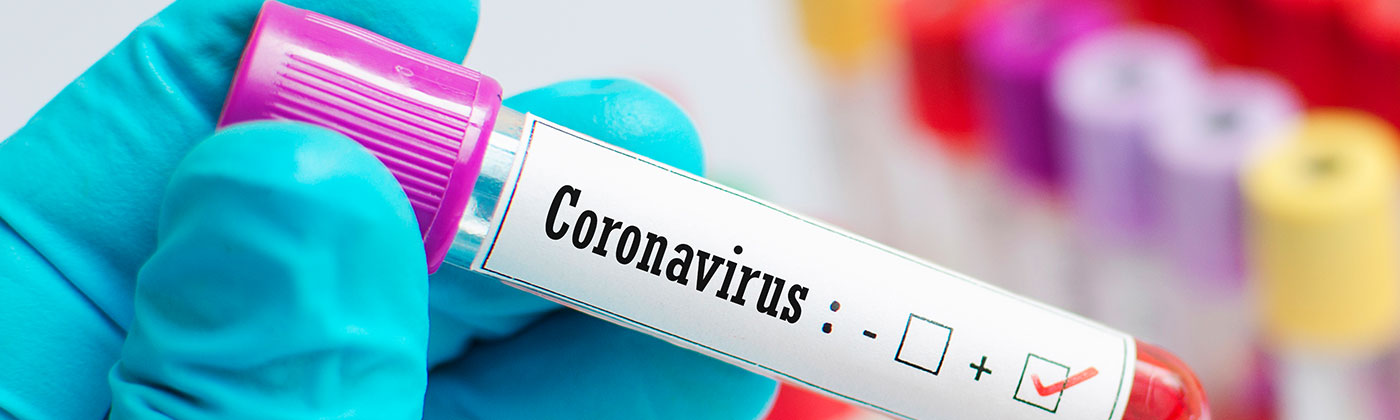 Coronavirus Vile Image